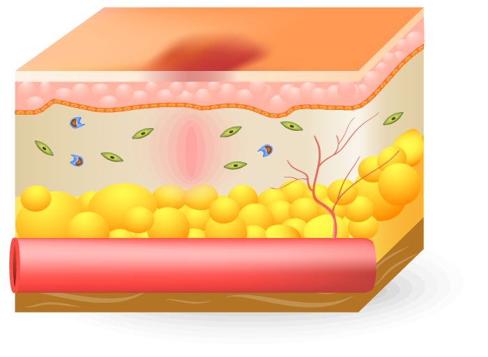 Proliferative Phase of wound Home Landing Page Health Factor Products 