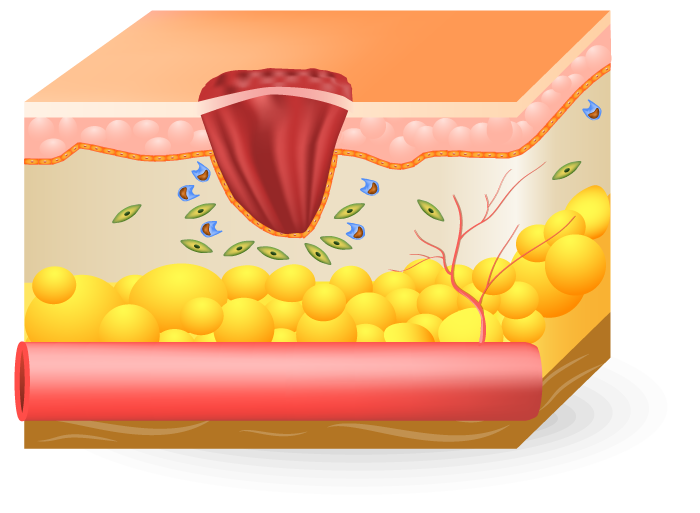 Proliferative Phase of wound Home Landing Page Health Factor Products 